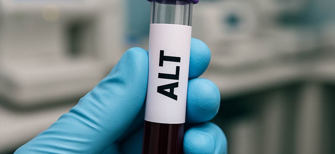 ALT