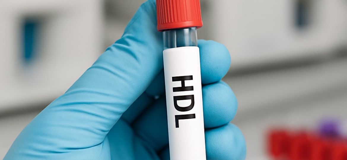 HDL