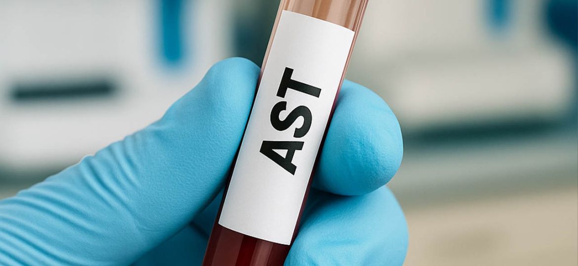 ast