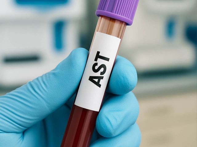 ast
